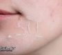 Dry Skin in Toronto Spa Treatments That Can Help Restore Hydration 90x80